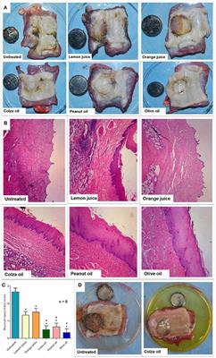 <mark class="highlighted">Edible Oils</mark> Attenuate Button Battery-Induced Injury in Porcine Esophageal Segments